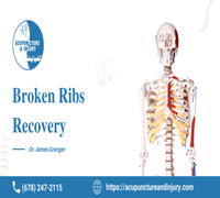 The best Guide for Broken ribs recovery from expert