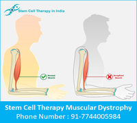stem_cell_therapy_for_muscular_dystrophy_in_india