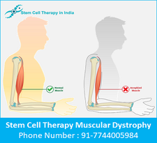 stem_cell_therapy_for_muscular_dystrophy_in_india