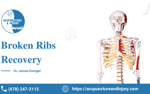 The best Guide for Broken ribs recovery from expert