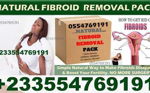 FIBROID TREATMENT IN GHANA